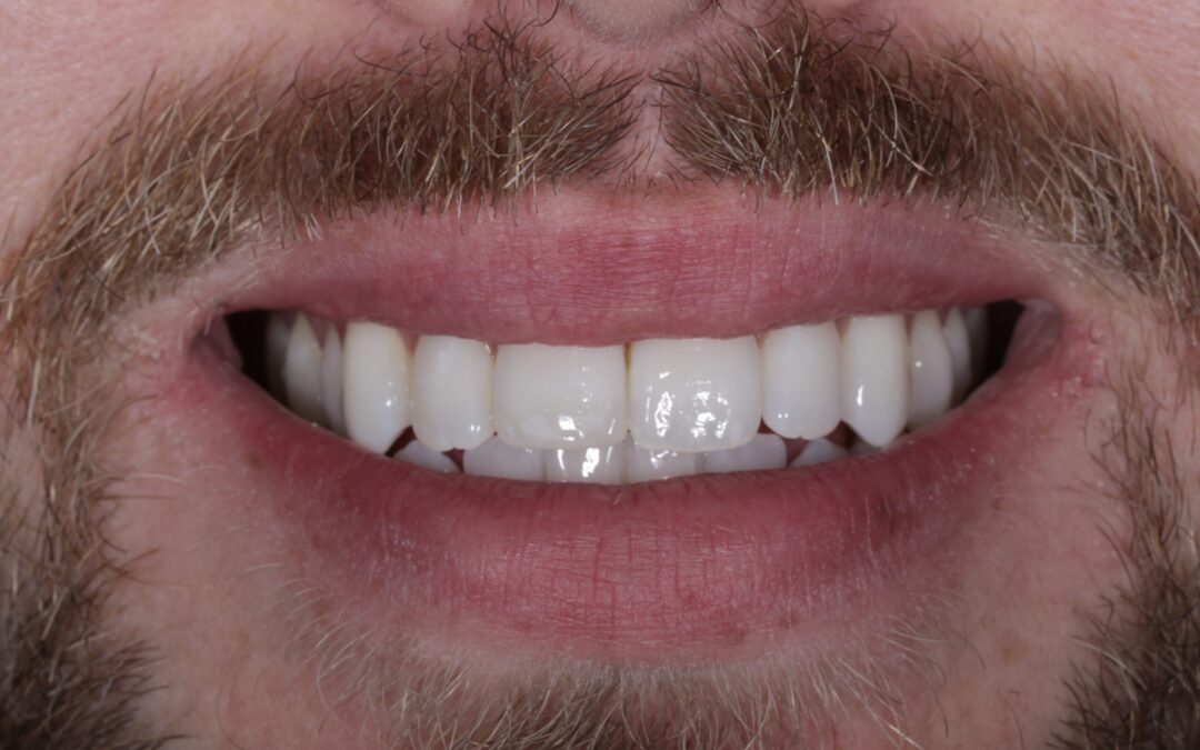 Invisalign Orthodontics