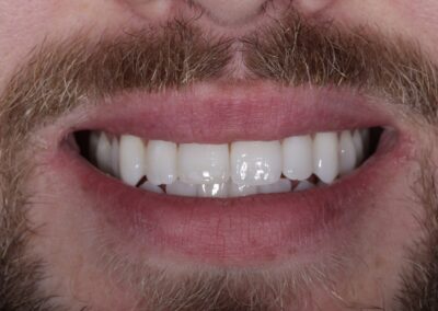 Invisalign Orthodontics